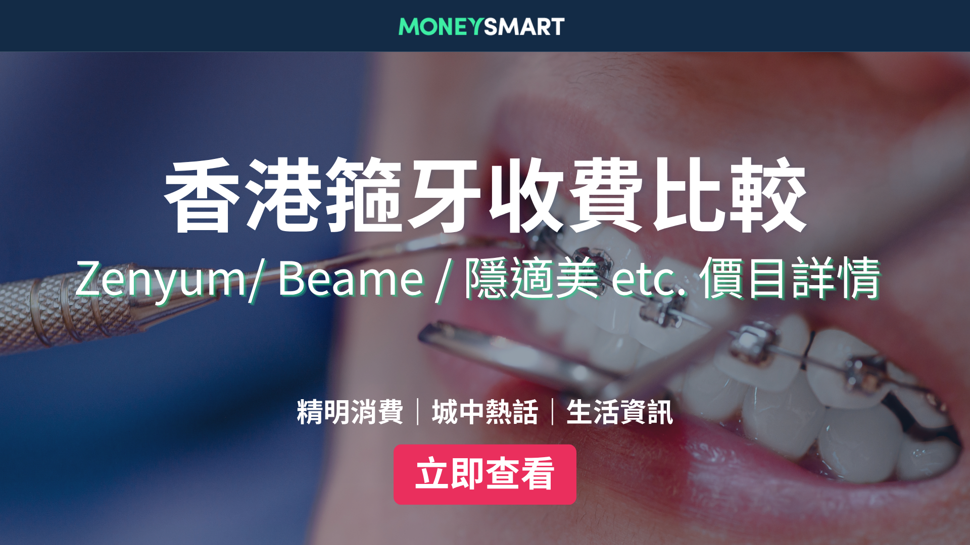 箍牙邊間好？2026香港箍牙價錢比較：Zenyum/ Beame / 隱適美 etc.
